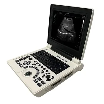 Ultrasound Machine For Veterinary / Human Sonostar Portable Laptop Ultrasound Machine