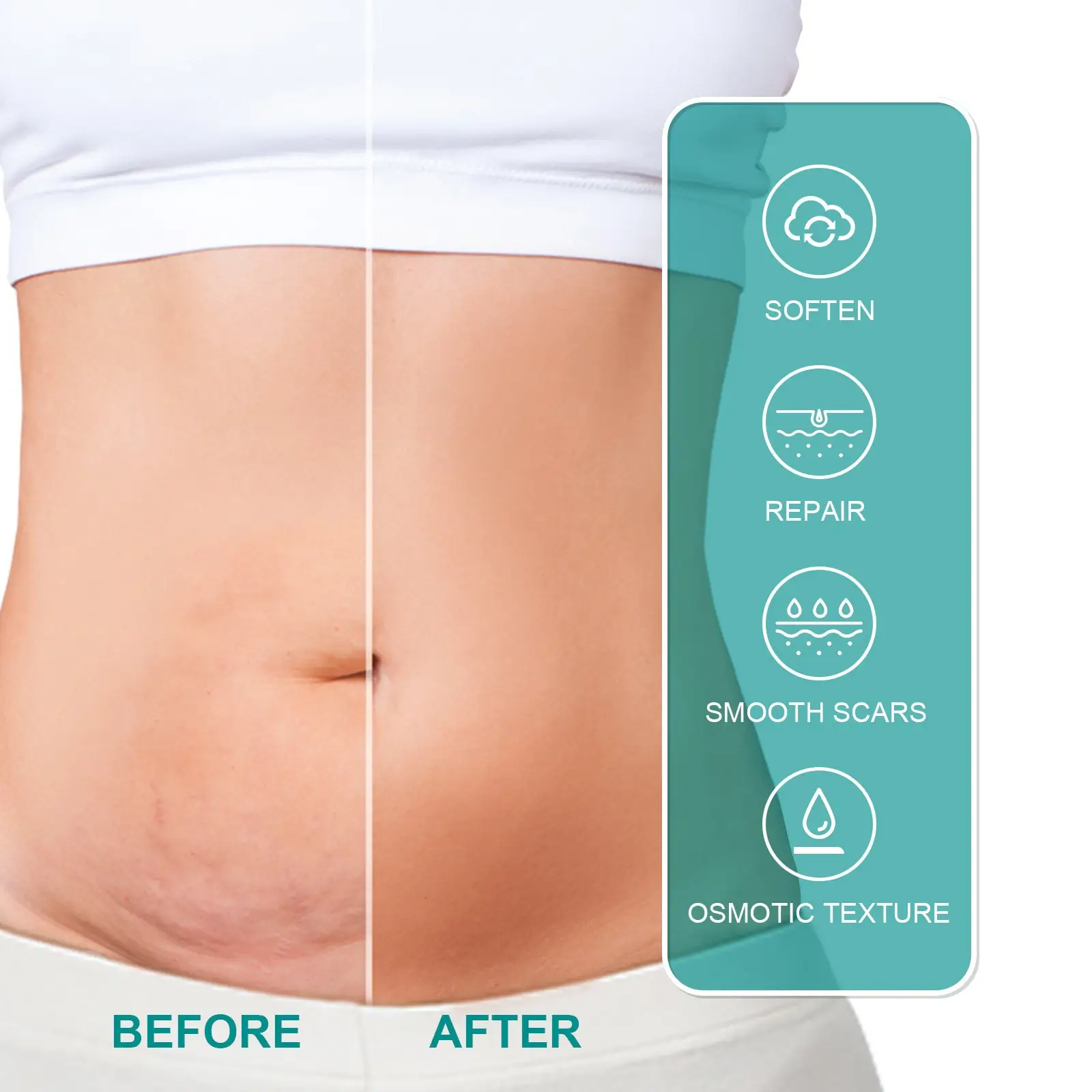 South Moon Scar Spray Cesarean Hyperplastic Contracture Burn Acne Surgical Scars Stretch Mark Keloid Treatment Liquid