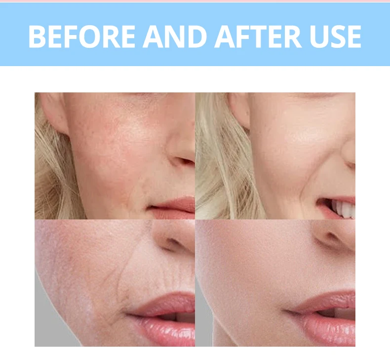 Natural Rose Facial Cream With Hyaluronic Acid Reduce Wrinkles Moisturizing Face Skin Care Firming and Tightening Face Cream