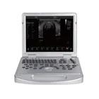 Probe Dawei Best Portable Veterinary Ultrasound Scanner System With Convex Probe