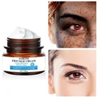 Freckle Cream Effective Face Chloasma Acne Dark Spot Removal Freckle Cream