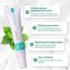 Skin Skin Care Dark Spot Repair Gel Face Pimples Whitening Acne Remove Scar Removal Cream