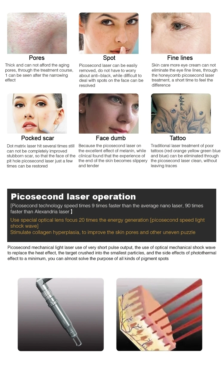 Máquina profesional de eliminación de tatuajes con láser Pico Picosecond Q Vertical con conmutación Nd Yag Laser
