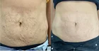 Sincoheren Salon Must Have Fat Reduce Weight Loss RF Cavitation Machine In Vertical Type