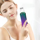 Skin Hot Selling Deep Face Cleaning Facial Spatula Ultrasonic Blackhead Personal Skin Scrubber