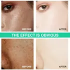 Freckle Cream Cream Anti Wrinkle And Freckle High Efficient Replenish Water Nourishing Shumin Repair Face Cream