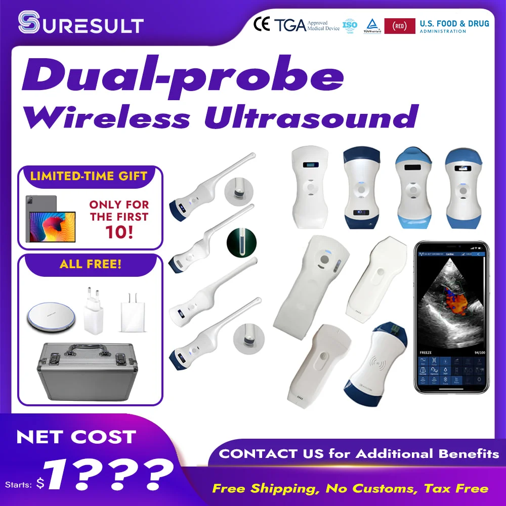 ultrasound probe for ios