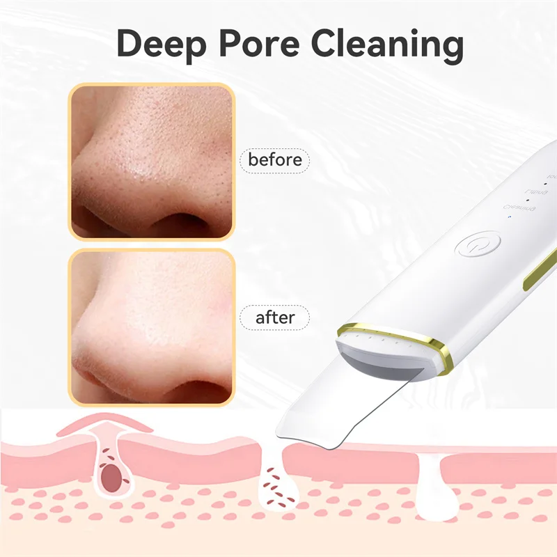 皮肤洗涤器面部刮刀毛孔清洁器黑头去除工具面部深层清洁4种模式