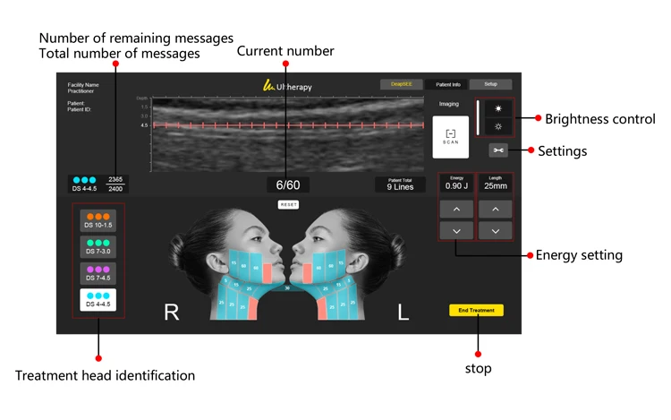 3rd Generation Ultra Lift HIFU Machine – Non-Surgical Face & Body Skin Tightening System 14 TECHNICAL SPECIFICATIONS <ul> <li>Power: 180W</li> <li>Voltage: 100V/110V/220V</li> <li>Screen Size: 18.5 inches touch screen</li> <li>HIfu Cartridges: ds10-1.5/ds10-1.5n/ds7-3.0n/ds7-3.0/ds4-4.5/ds7-4.5</li> <li>Cartridge Shots: 10,000 shots</li> <li>Dot distance: 1-2mm(Set unit 0.1mm)</li> <li>Frequency: 10MHz/7MHz/4MHZ</li> <li><span class="attr-name J-attr-name" title="HIFU Length" data-spm-anchor-id="a2700.wholesale.0.i34.67a066f4kJ6h3j">HIFU Length: </span>5.0~25mm 1mm/step</li> <li>Package Size: 55*54*37CM</li> <li>Package Weight: 21 kg</li> <li>ReturnPolicy: <b class="magic-5"><span style="color: #2196ed;">30 Days Money back guarantee</span></b> <a href="http://skintechx.com/refund_returns" data-sm="true">Return Policy</a></li> <li>ShippingDetails: <b class="magic-5"><span style="color: #2196ed;">FREE SHIPPING fast delivery</span></b> <a href="https://skintechx.com/shipping-policy" data-sm="true">Shipping policy</a></li> </ul> 3rd Generation Ultra Lift HIFU Machine – Non-Surgical Face & Body Skin Tightening System