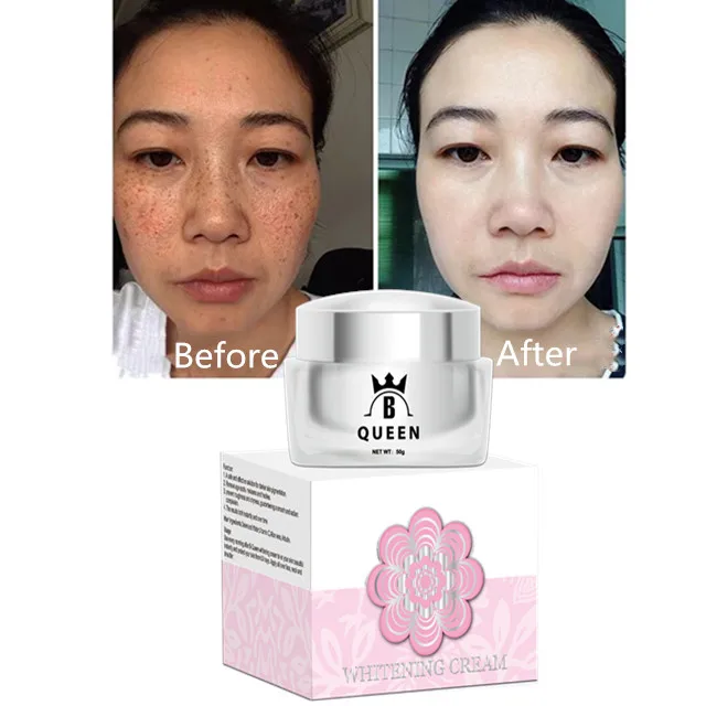 Chinese Clear Beauty Collagen Best Skin Whitening Face Lift Cream For Black Skin Women - Buy Skin Whitening Cream For Black Skin,Baby Skin Whitening Body Cream,Dark Whitening Cream Product Alibaba.com