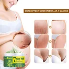 Natural Days Cream Natural Organic OEM 7 Days Maternity Treatment Pregnancy Repairing Stretch Mark Cream
