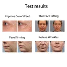 Wrinkle Kizoku Manufacturer Whoelsale RF EMS Beauty Products Wrinkle Remover Care Facial Skin