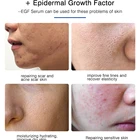 Activating OMY LADY A+B Combination Anti Wrinkle Repair Skin Serum Moisturizing Gold EGF Activating Serum
