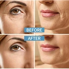 Light Cream Huiju LONACEIH Improve Wrinkles Eye Mouth Lines Tropical Rain Forest Light Sensing Essence Cream
