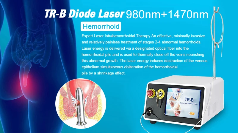 Anorectal Laser Hemorrhoids Fistula Surgical Diode Laser 980nm 1470nm