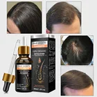 Hair Growth Treatment Regrowth Hot Selling Hair Growth Essential Oil Hair Loss Treatment Fast Hair Regrowth Serum
