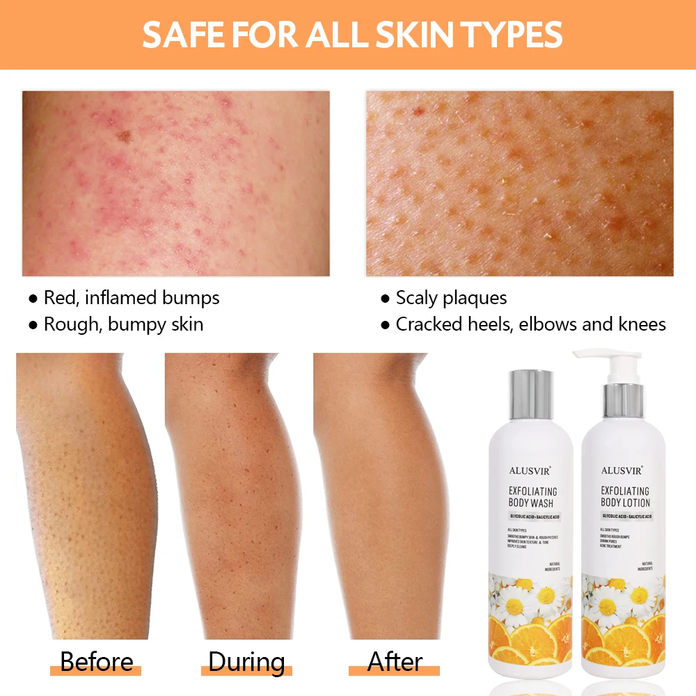 Dead Skin Remover Salicylic Acid Skin Peeling Body Wash Gel Lotion Care Set For Women Black Skin Private Label