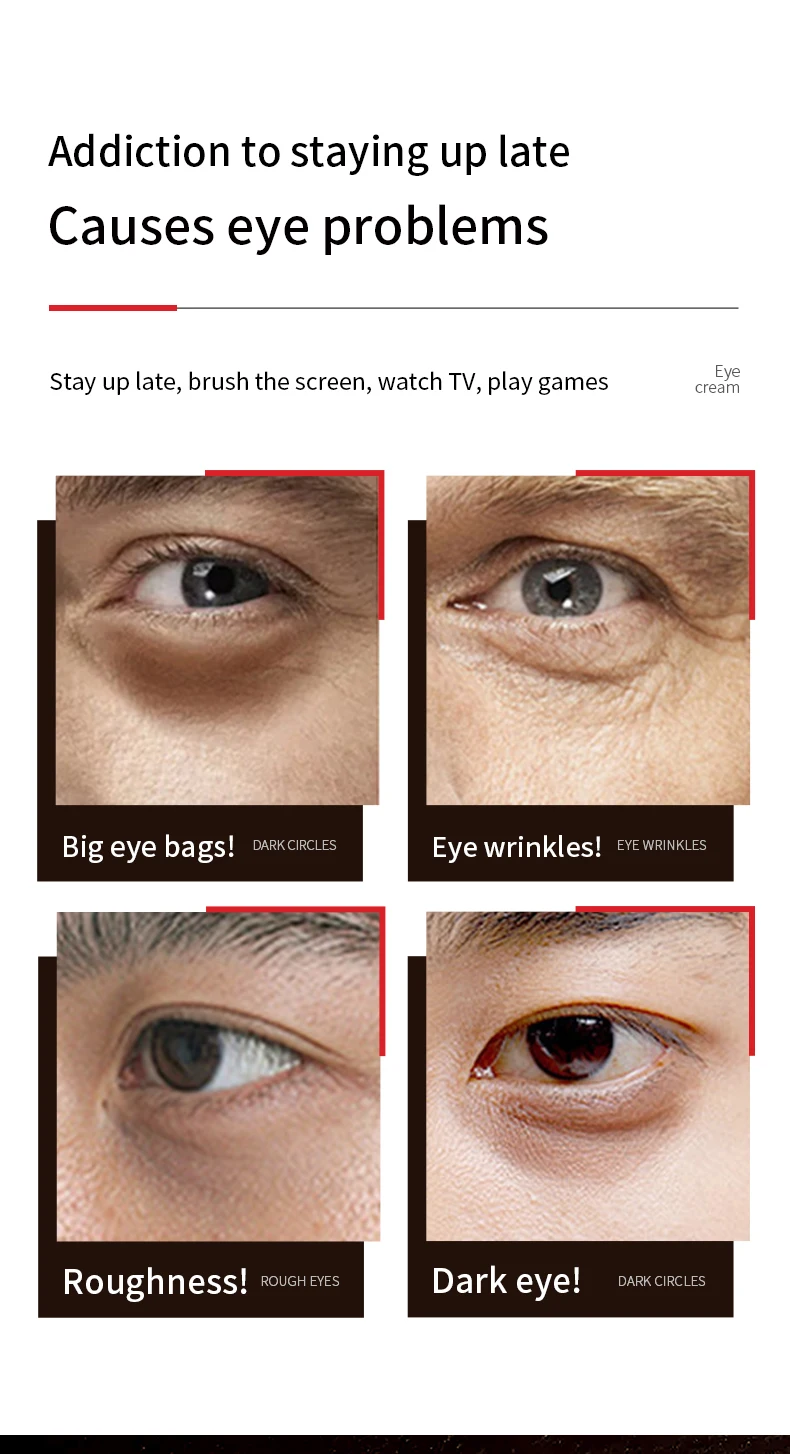 product etae mens eye cream anti wrinkle and moisturizing with firming function dark circles relief oem supply-3