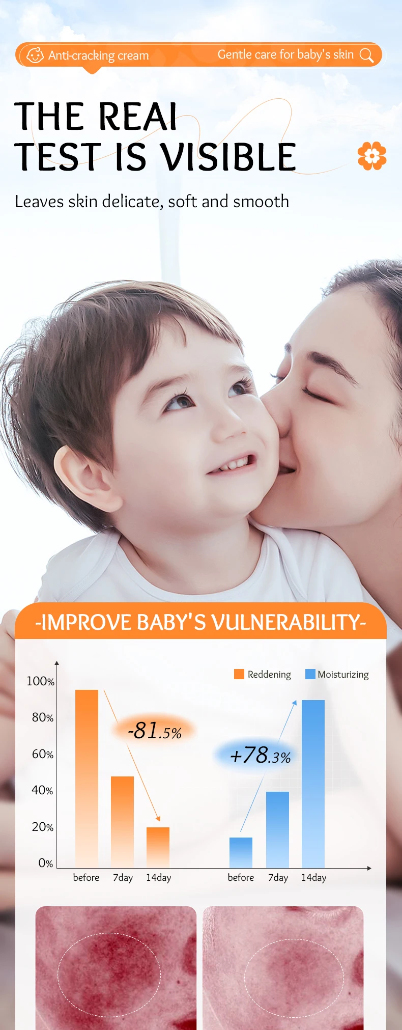 product organic skincare sadoer childrens calendula vitamin e gentle soothing anti chafing repairing moisturizing cream for children-7