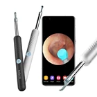 Wifi Phone Bebird R1 Smart Ear Pick Stick With Wifi Micro Scope Available On Your Smart Phone
