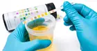 Test Blood Test Strip Urin Urine Test Strips Blood