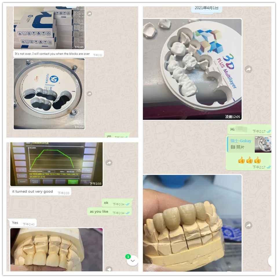 Yucera Dental 3D-Plus Zirconia AG System Cad Cam Dental Zirconia Bloque Para Lab