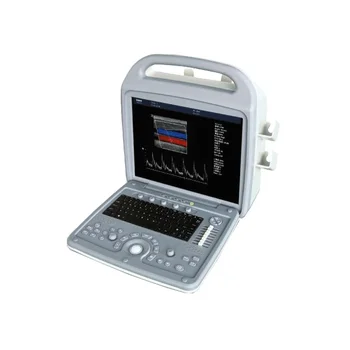 Hot Sales!! doppler ultrasound machine
