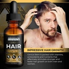 Hair Growth Loss Hair Growth Treatment OEM Hair Growth Serum Ginger Hair Growth Oil Best Hair Loss Prevention Treatment
