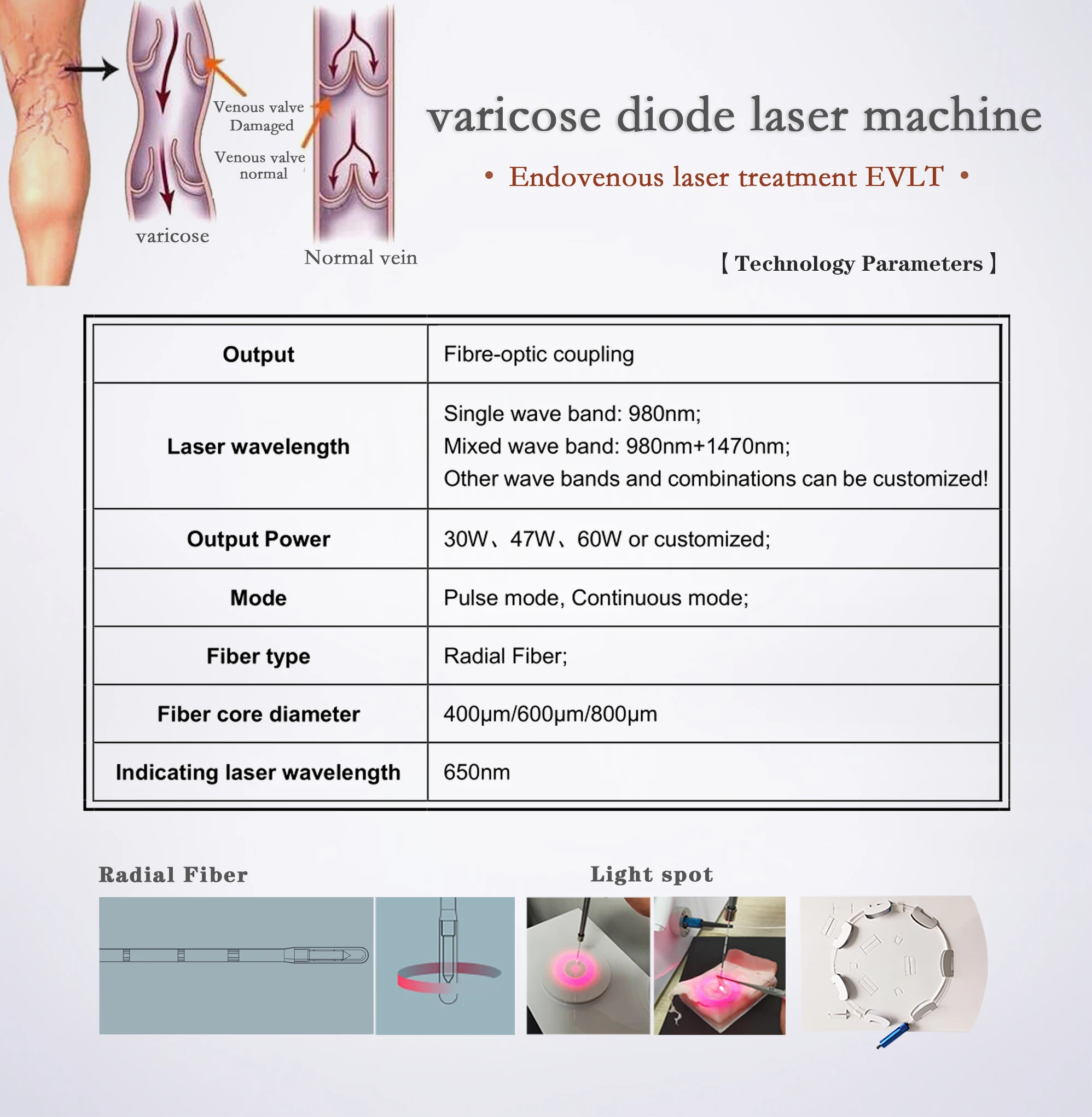 1470 Nm Vagina Tightening Gynecology Potable Diode Laser 980nm1470nm