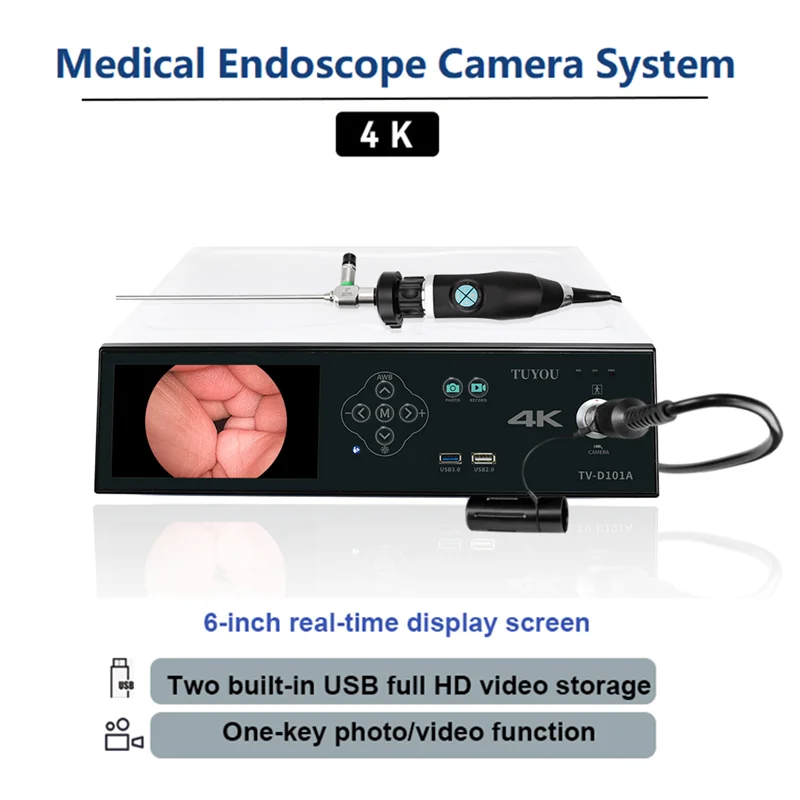 K Ultra Endoscopy Camera Endoscopic Endoscope System Gastroscope And