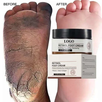 Care Body e for Cracked Heels Beauty Products Skin Rejuvenation Foot Moisturizer Cream