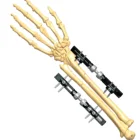 New Radiolucent Wrist External Fixatior