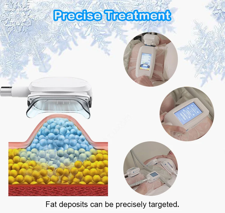 Apolomed Cryolipolysis Machine for Body Slimming factory