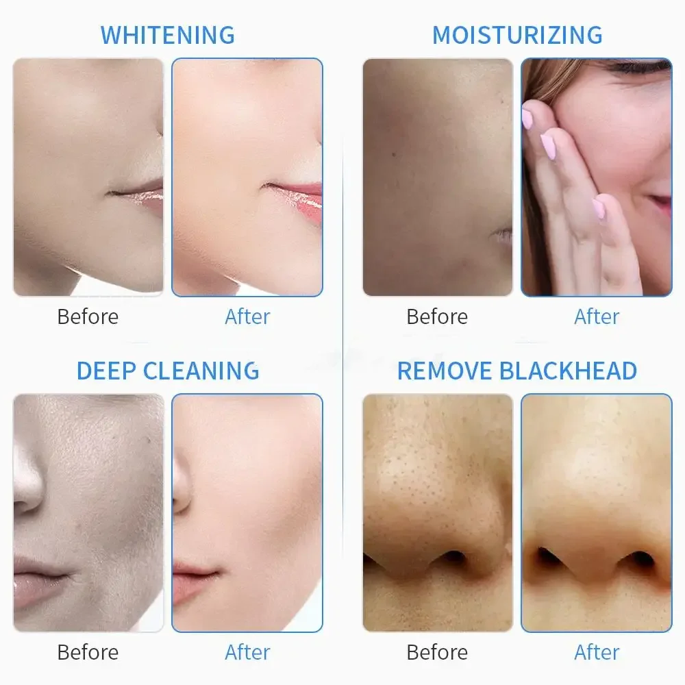 2024G 7 In 1 Hydro Peel Skin Scrubber Smart Ice Blue Beauty Machine With Skin Scanner For Spa Use Cleansing Rejuvenating