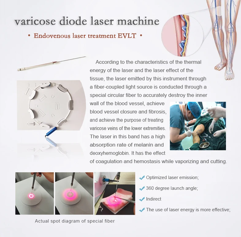 1470 Nm Vagina Tightening Gynecology Potable Diode Laser 980nm1470nm