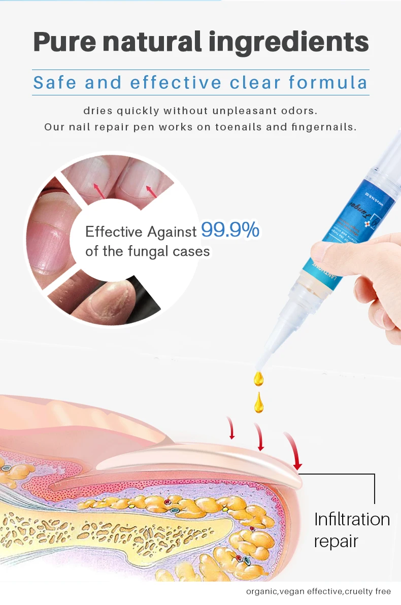 Lanthome 4ml Anti Fungal Nail Treatment Nail Repair Pen For