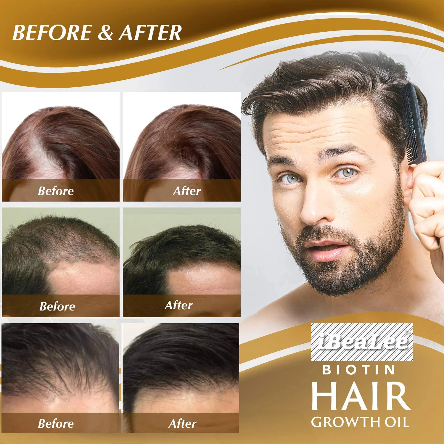 Hair Growth Vitamin For Man Buy Hair Care,Hair Serum,Antihair Loss