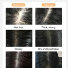 Dandruff Dandruff Shampoo Ginger Scalp Care Shampoo For Anti Hair Loss Anti Dandruff And Promoting Hair Regrowth