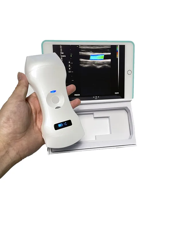 Elements Convex Linear Phased Array Color Doppler Ultrasound