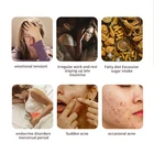 Skin OEM ODM Face Care Essence Acne Treatment Whitening Moisturizing Facial Serum Skin Care Serum Face Serum