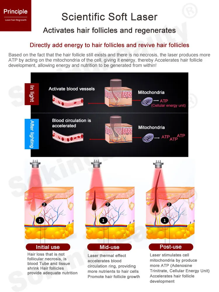 5 in 1 high frequency oxygen therapy hair regrowth scalp treatment analyzer laser hair growth machine for hair loss