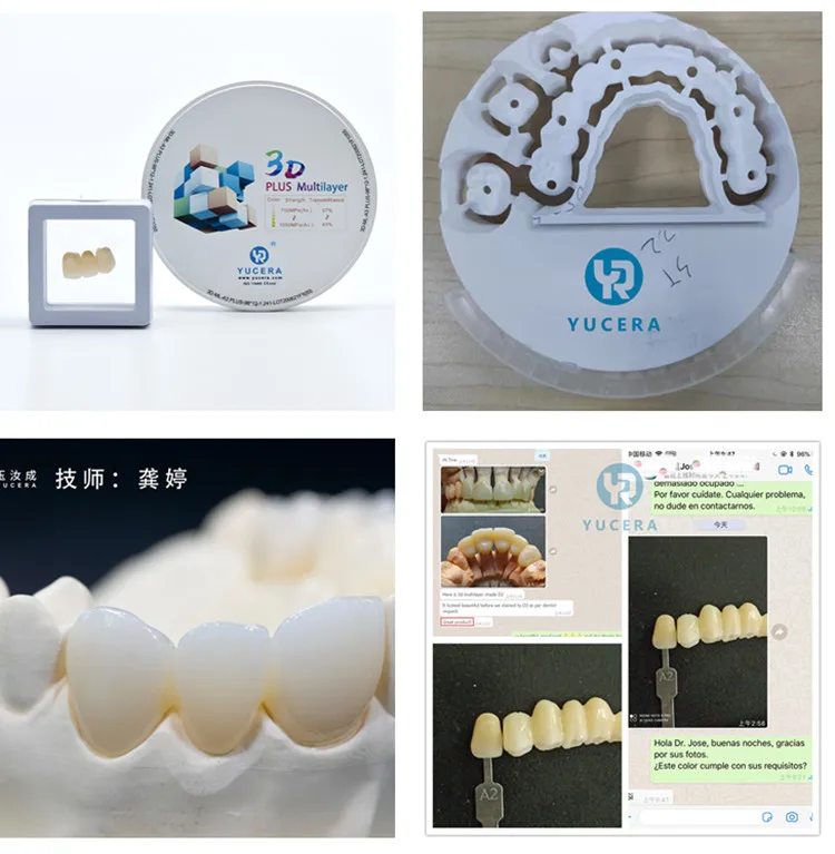 Yucera Dental 3D-Plus Zirconia AG System Cad Cam Dental Zirconia Bloque Para Lab