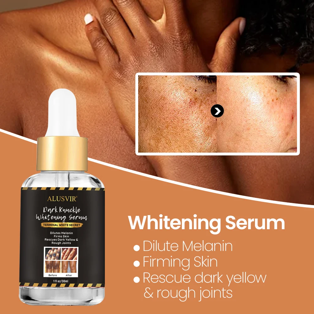 Korean Cosmetics Strong Dark Knuckle Body Whitening Serum Dark Spot Correcting Remover Glow Skin Care Serum Liquid Face Female