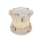 Model Removable Detachable Implant Tooth Model YJ703