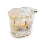 Teeth Dental Restoration Restoration With Implant Dental Teeth Model / Implant Teeth Model