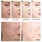 Night Cream Night Night Cream 2021 Best Sale Amazon Supplier Private Label Whitening Night Face Cream For Dark Skin
