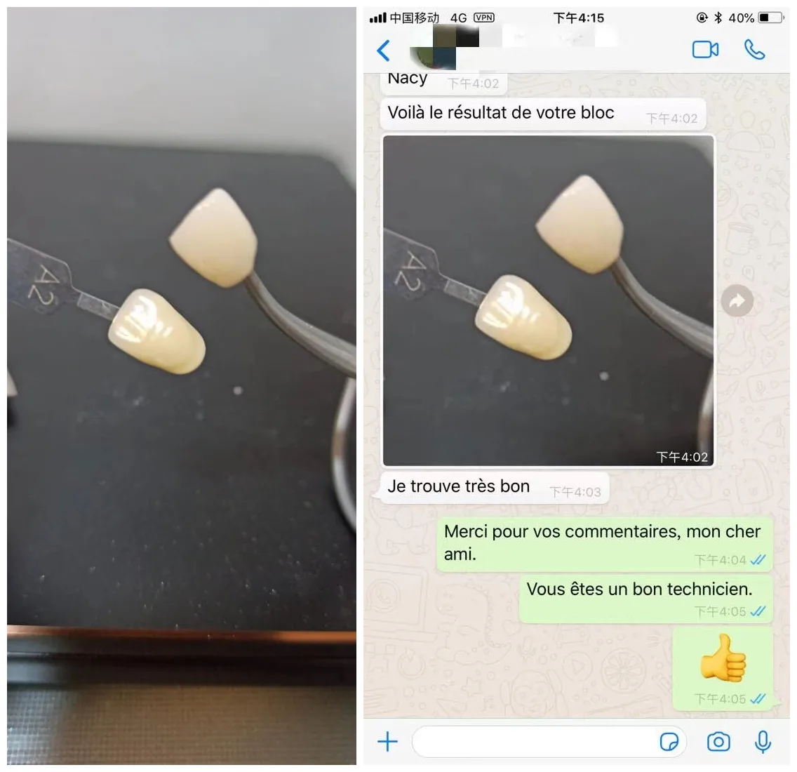 YUCERA ST White Zirconia Block Dental Lab Use Cad Cam 98mm White Blank Zirconia Blocks for 5 Axis Dental Milling Machine