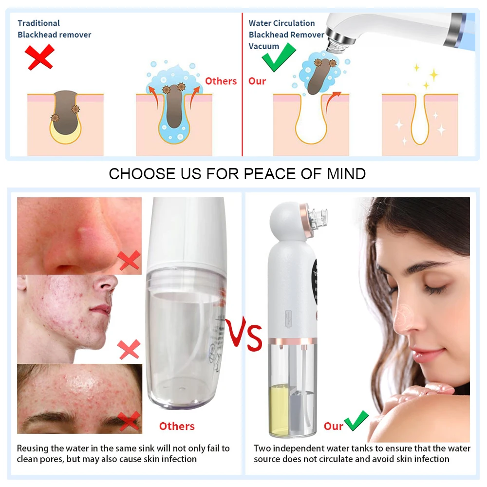 Home Use USB Rechargeable Beauty Machine Facial Deep Cleansing Pore Vacuum Blackhead Remover