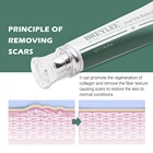 Natural Fast Effective Natural Herbal Acne Scar Treatment Removal Cream