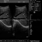 Laptop Obstetrics Gynecology Ecograph Digital Ultrasound Scanner Diagnostic System